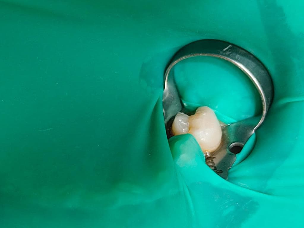 Specialized Endodontic Care